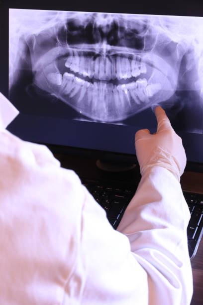 Best Emergency Treatment for Dental Infections or Abscesses in South Elgin, IL